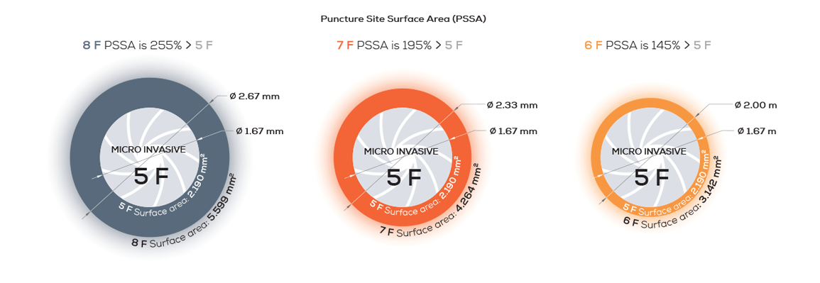 PSSA Diagram
